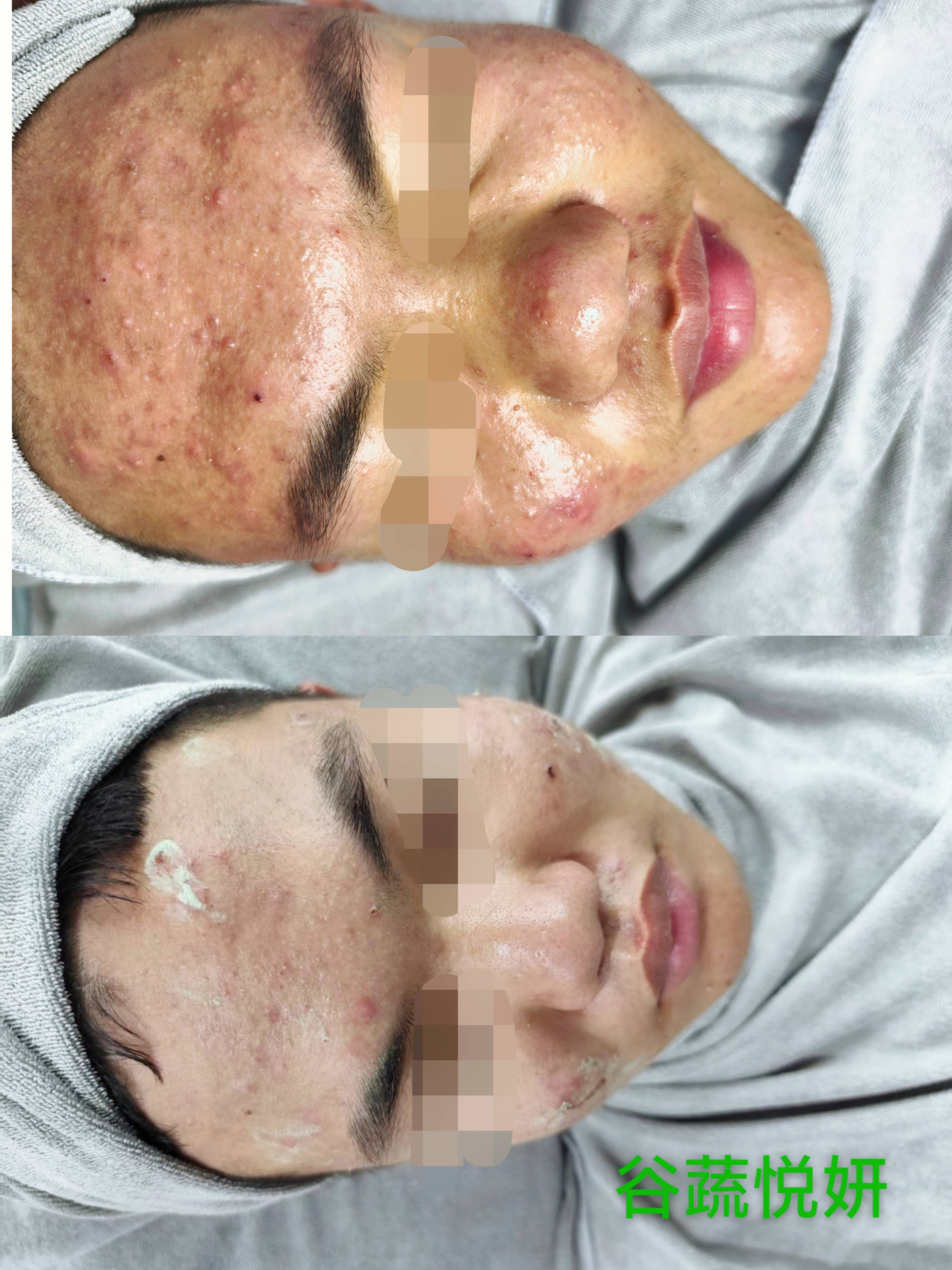 护肤前后对比照片